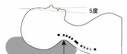 颈源性|再见,颈椎病!用好自愈力,自己就是好大夫,每天康复锻炼五分钟