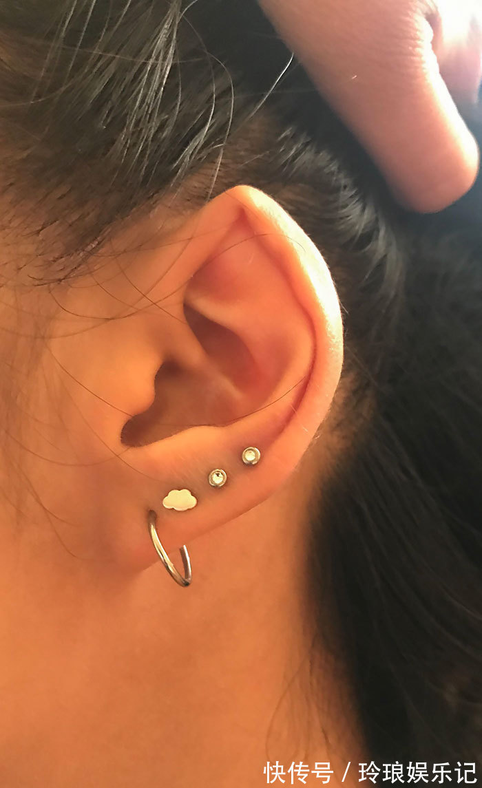 脚趾|19个“被上帝挑选过”的特殊基因人类,怎么梳都不整齐的头发