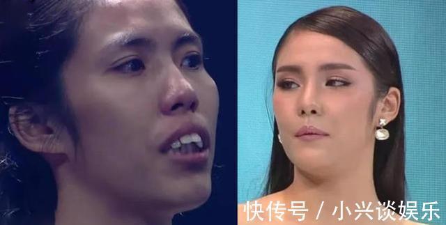 美女|女子长得太丑嫁不出去,整容后变成美女,连自己的亲妈都没认出来