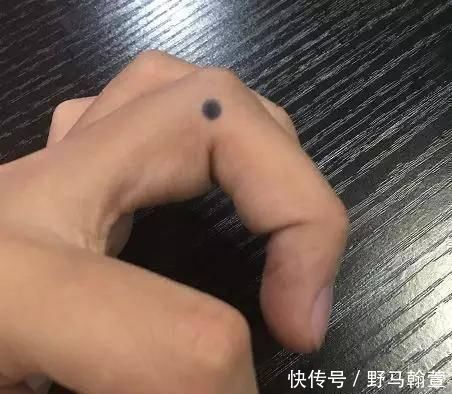 头疼|手上有四个穴位,可疗一切头疼,一起来了解一下吧