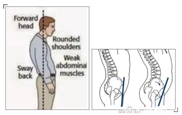 小肚腩|腰腹赘肉:藏着代谢不掉的湿浊垃圾!4个方法去除,你也可以!