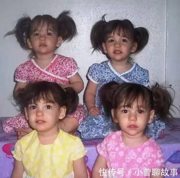 妻子|妻子怀双胞胎7个月时发现不对劲 生产时丈夫惊呆