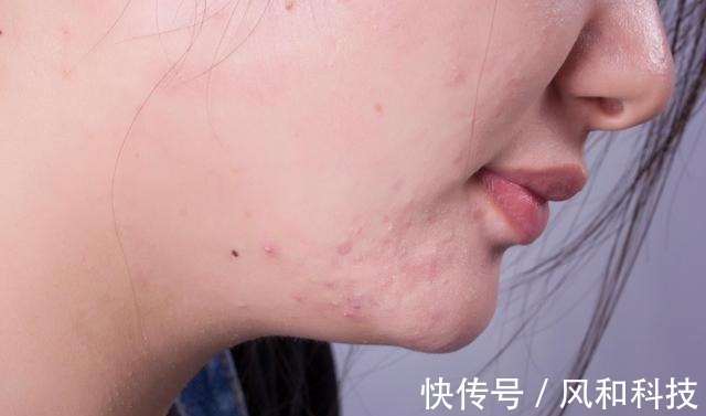 祛濕法|濕氣重，百病生，不花錢的祛濕法堅持做，祛濕排毒一身清爽