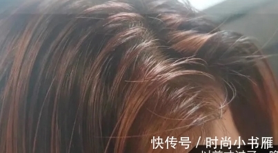 头皮|已被拉入“黑名单”的洗发水,学生党却偏爱,难怪头发“大把掉”