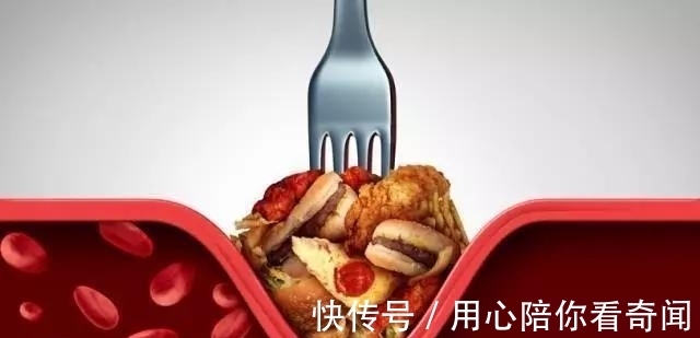 高血脂|血脂高的人有哪些表现呢?建议大家少吃这几种食物