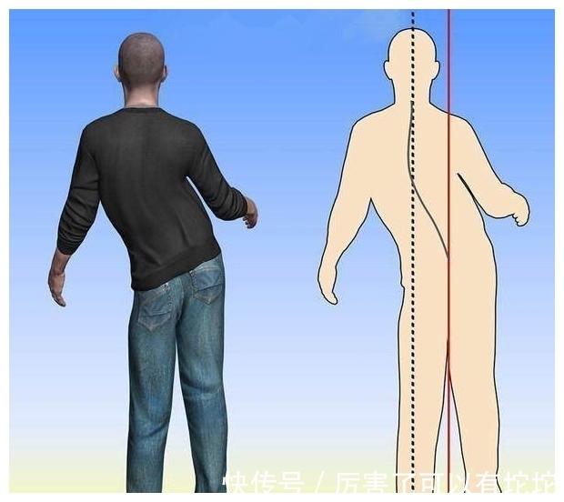 先兆|身上有这6个特征,小心脑血管已堵塞,预防脑梗,谨记两个达标!