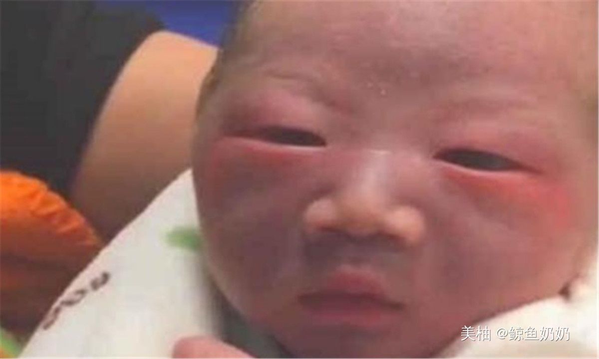 护士|丑娃出生连亲妈嫌弃，护士却夸漂亮，一个月后宝妈连连感谢