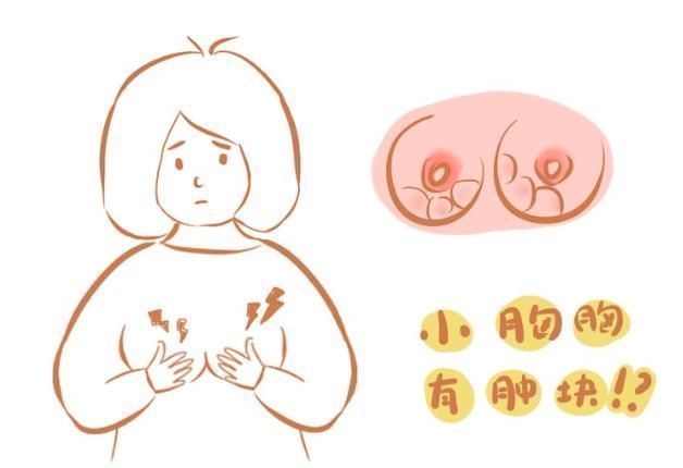 癌症|女性乳腺癌发作前，身体会发出这6种异常信号，越早发现越好