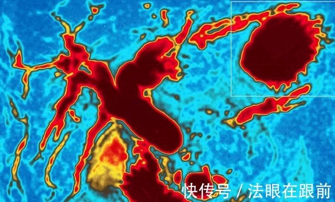 放疗|“癌症之王”晚期还有“希望”吗?重离子放疗有望提高治疗预后