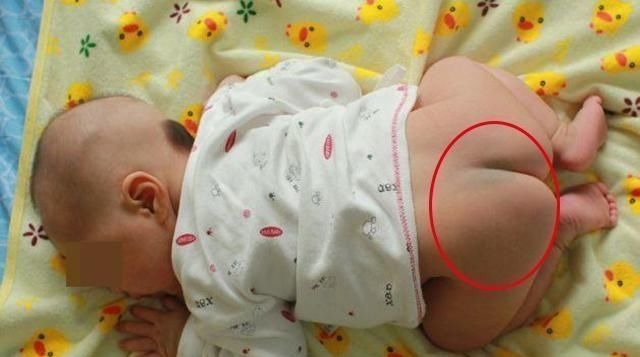 护士|发现新生儿小屁屁上有“淤青”,老公想找护士理论,最后暗暗庆幸