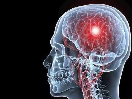 健身房|28岁小伙高血压，在泳池里离世，医生感叹，有些悲剧明明可以避免