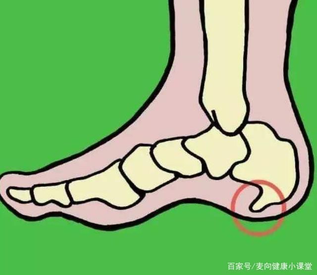 痛风拇外翻|足底筋膜炎，足跟痛，崴脚跟腱炎，痛风拇外翻 您是哪个位置疼痛