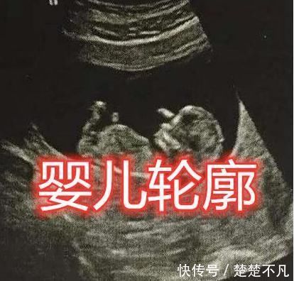 照片|“失恋博物馆”有多伤人?婚纱、B超、验孕棒没啥,心疼最后的男孩