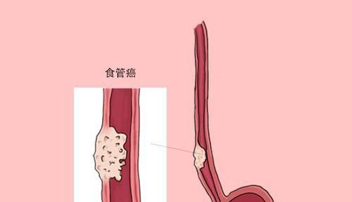 吃饭和寿命有关？吃饭时，保持3个习惯的人，身体一般会比较好