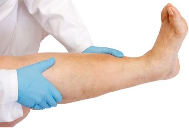 发展期|近期腿部反复有以下三个症状,这就可能是癌变的信号