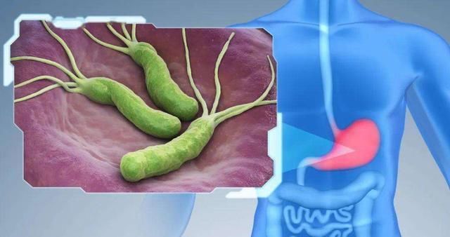 胃病开始恶化时,吃饭会有3种表现,若一个不占,胃癌离你还很远