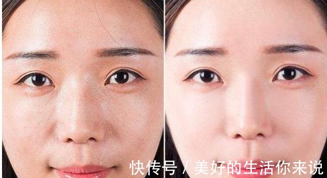 毛孔堵塞 脸上“毛孔堵塞”该怎么办护肤做好这几步,减少皮肤困扰!