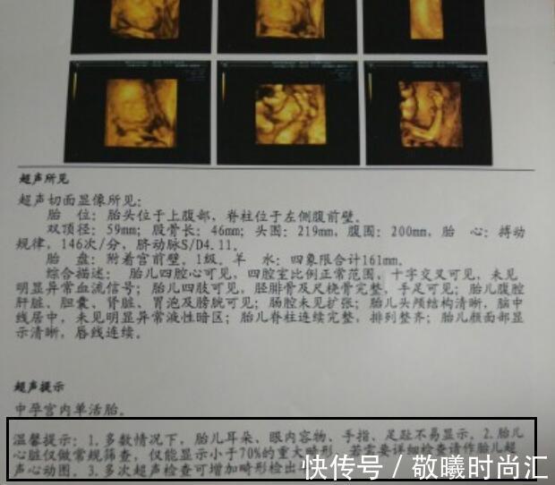 染色体|同样是怀孕,为啥单胎需要做唐氏筛查和四维彩超?而双胎没必要做