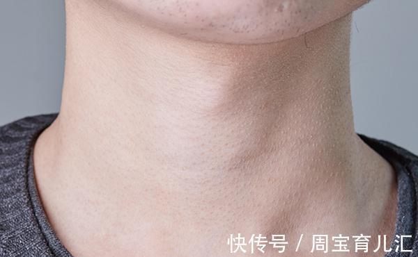 恶性|甲状腺结节分等级，发展到几级会成为癌症？甲状腺可以自愈吗？