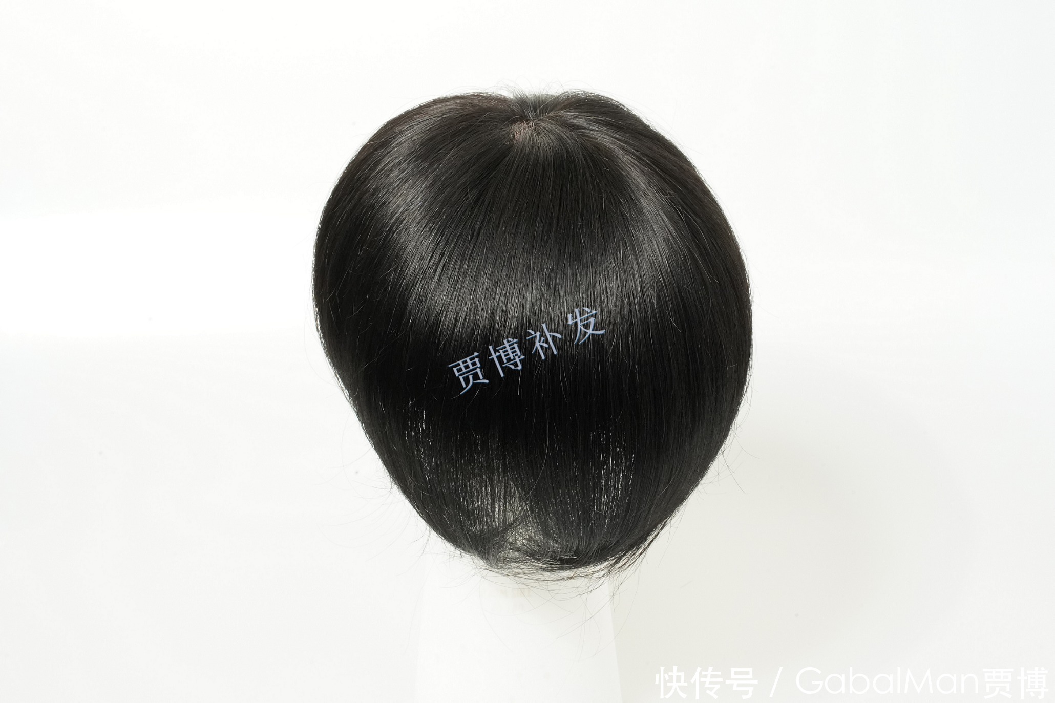 发际线脱发|60分钟拯救你的发际线!告别高额头,让你更显年轻