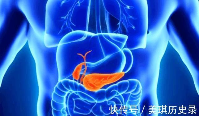 胰腺囊肿|胰腺癌为何发现多为晚期?高危人群有哪些?跟糖尿病有关系?
