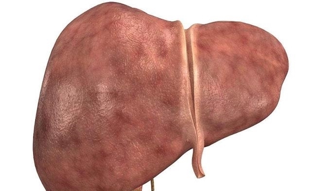 肝不舒服的人,早起半小时,多做3件事,肝慢慢变好