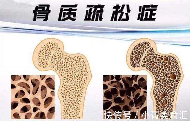 牛奶|喝牛奶与不喝牛奶老人,差别真的很大吗?医生说出实话,不妨了解