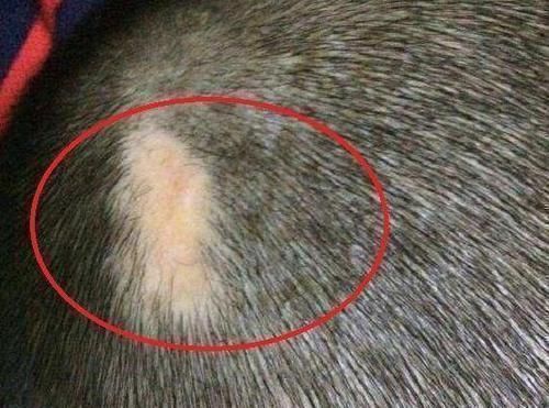 自愈能力|剖腹产划伤孩子头部,医生很快就会好的,7年后家长找上医院