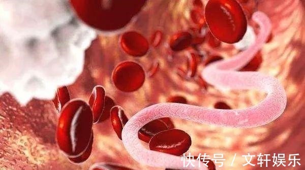 高血脂|晚上睡觉如果出现以下四种表现,八成是血脂过高,及时去医院检查