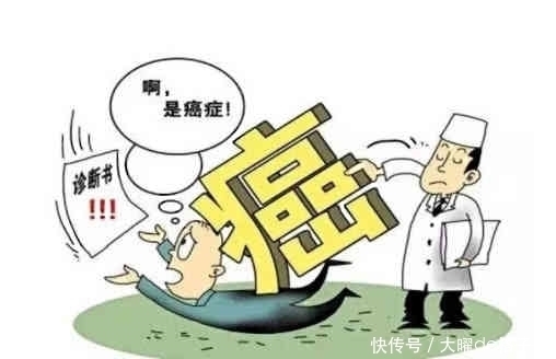 肝脏|肝癌“来势汹汹”?手指出现一“异常”,肝脏已在悄悄“癌变”