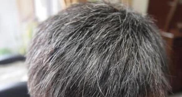 白發別再染黑,學會這4招,頭發變白,一年省下不少錢