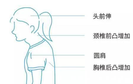 上胸|上胸发力总不好、练不大，原来是因为“它”，我们应该如何改善