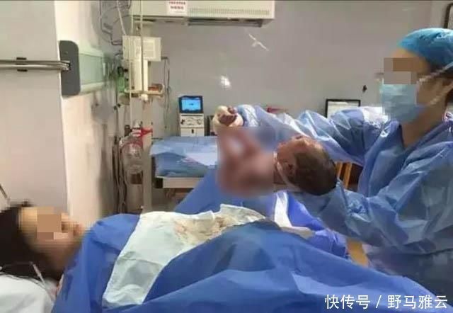 二胎政策|生下双胞胎后,产妇却大喊“等一下”,医生检查后,发现意外惊喜