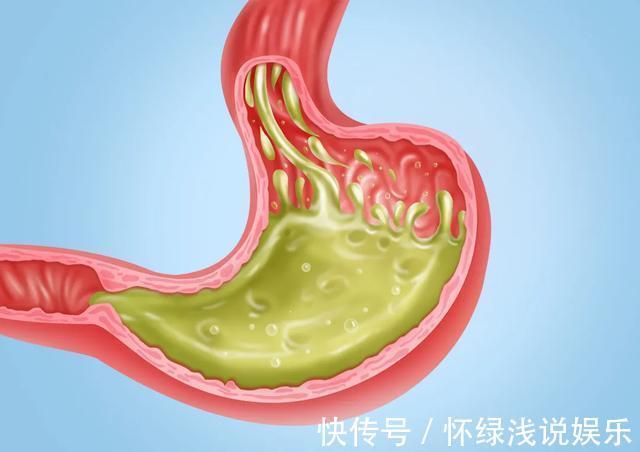 胃病|吃出来的老胃病，怎么养才不复发？养胃，中医有妙招