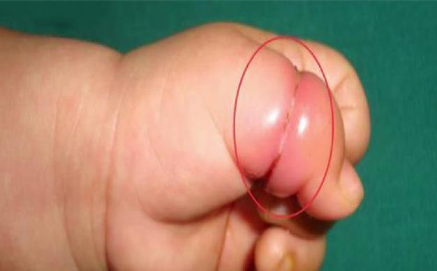 医生|1岁的宝宝一直在哭，医生检查没有结果，宝妈打开襁褓中的衣服，全家都在哭