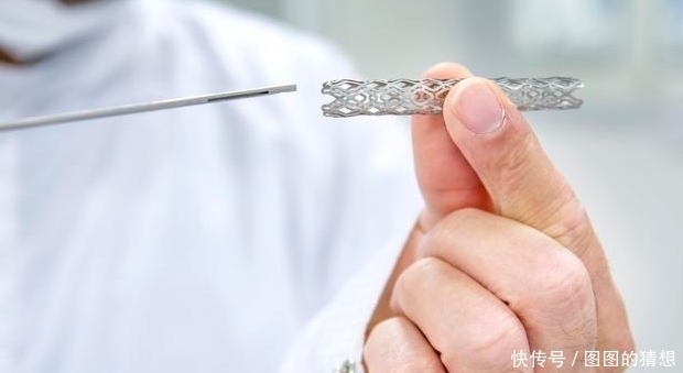 滥用心脏支架,遭钟南山批评,这2种情况才真的需要安放