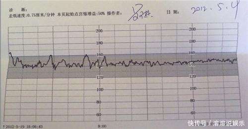 胎心|做B超时别再问医生胎宝宝性别了，是男是女，自己看单子也能分辨