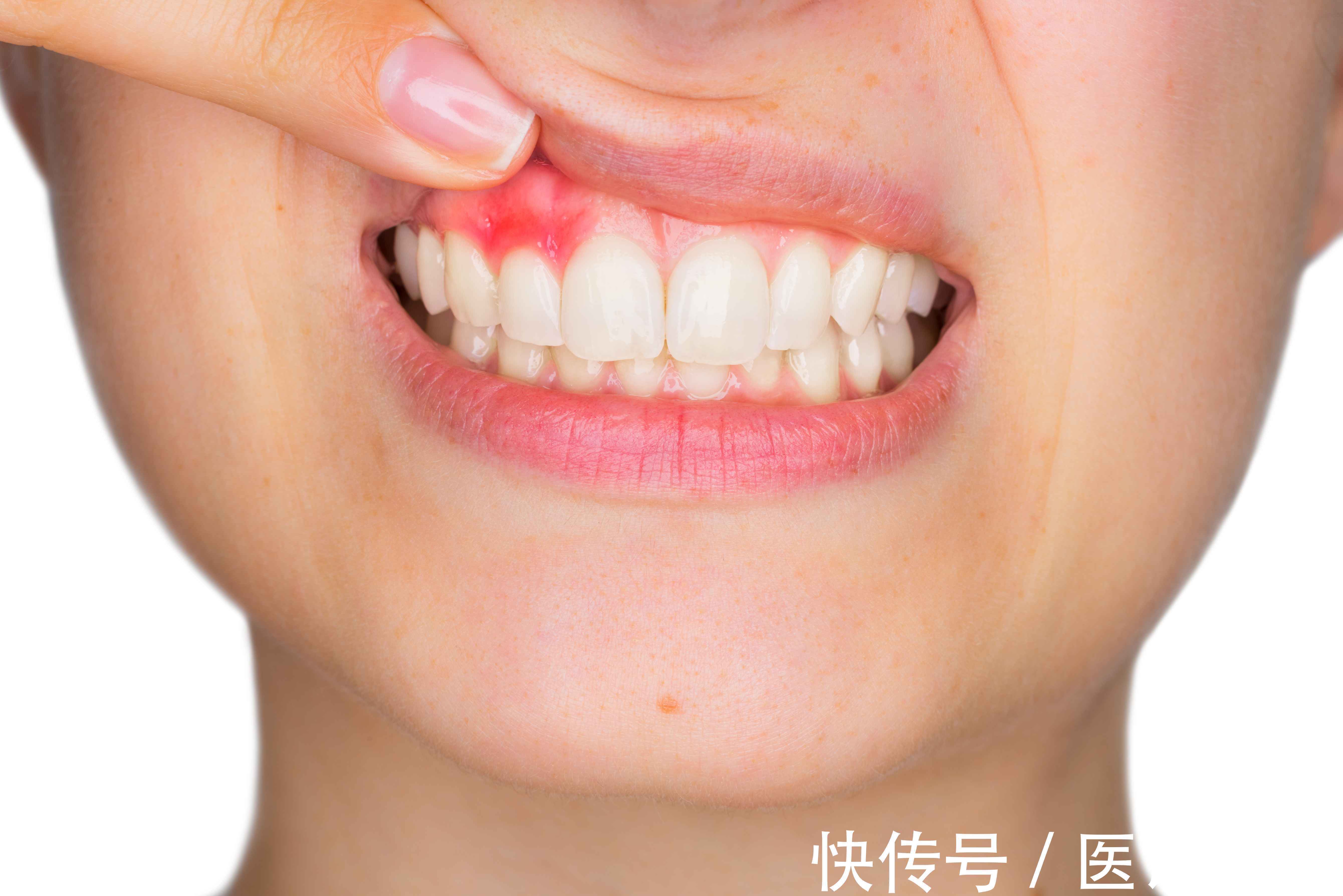 牙龈|预防牙周炎，坚持做好这4点，或能有效改善，避免加重牙齿损伤