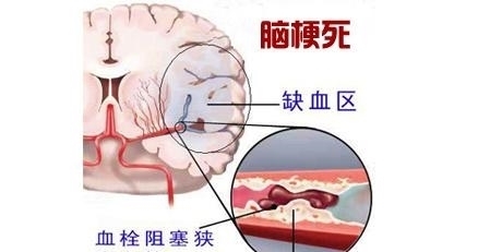 过于肥胖的人,身体可能会有7大危害,要引起重视!