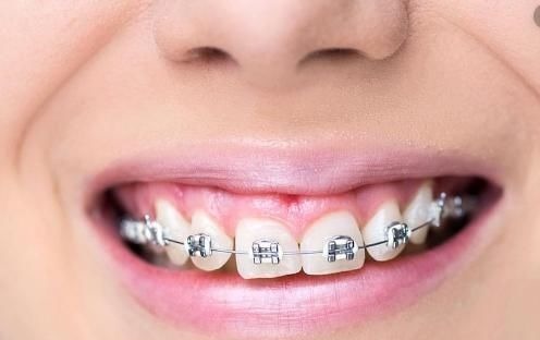 牙医|孩子换牙齿,新长的牙齿却是歪的,可能是家长这些没做好