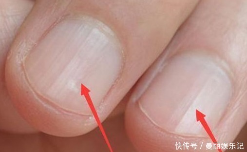 肝脏好的人，手上都有这“5个标志”，看看你的手上有没有