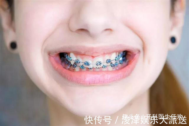 矫正|儿童牙齿矫正的黄金时期,家长们不要错过了!