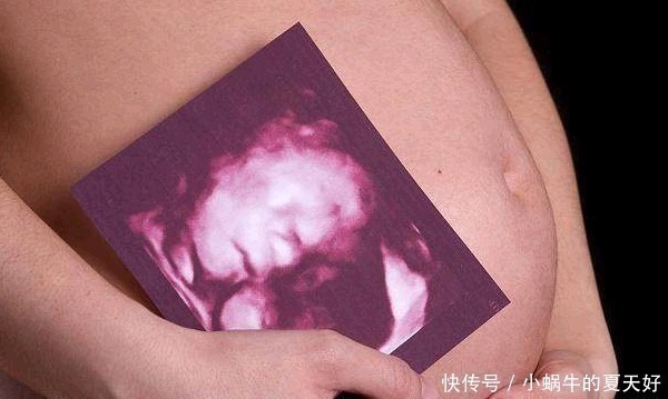 女性|为什么现代女性胎停孕越来越常见罪魁祸首是因为这3个原因