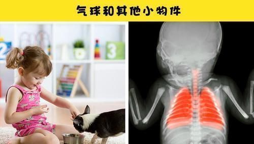 伤害|生活中可能会对孩子造成潜在危险和伤害的8个物品