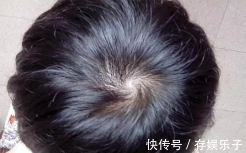 小伟|孩子头顶几个旋暗示着什么?别乱猜,科学的解释爸妈要牢记