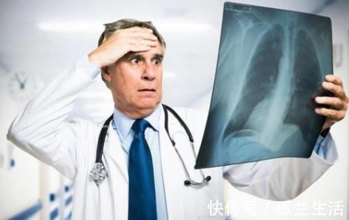 主任|癌症晚期还可以活多久?医院主任:说了3句“大实话”!