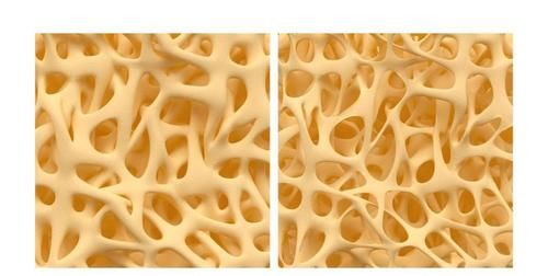 月经不调|医生表示:女性身体若是出现这3个症状,或是雌激素下降的表现