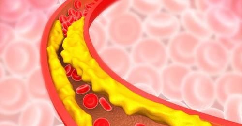 苹果|苹果能否降血脂?医生提醒:做好这“3件事”,或能有效降血脂