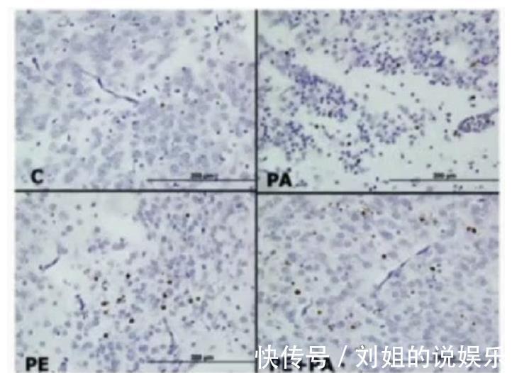 危险因素|影响胎儿“脑发育”的4个因素，一定要注意了！