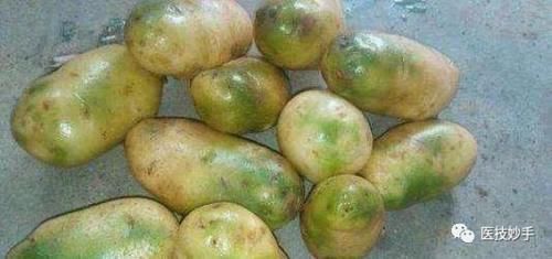 黄豆|发芽的蔬菜能不能吃?这4种蔬菜发芽后不仅没毒,反而营养更足